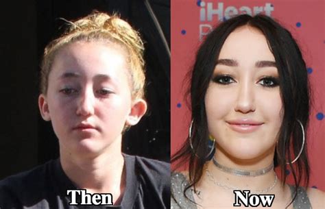 noah cyrus plastic surgery|Randomly came across a photoshoot of Noah Cyrus from last